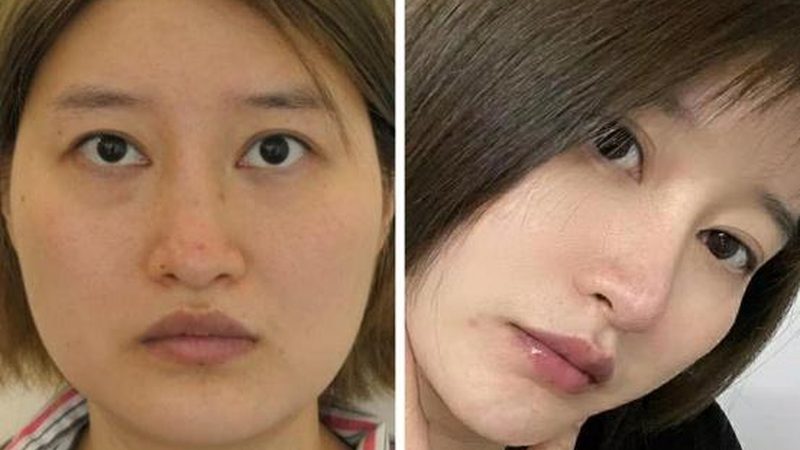 激光美容仪器OEM代工厂家：揭秘行业背后的技术秘密