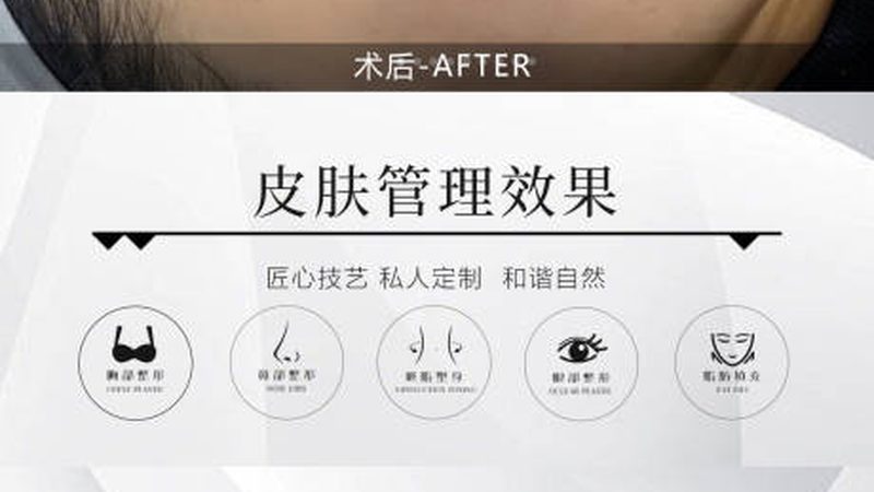 抗衰仪器品牌排名的真正参考价值在哪
