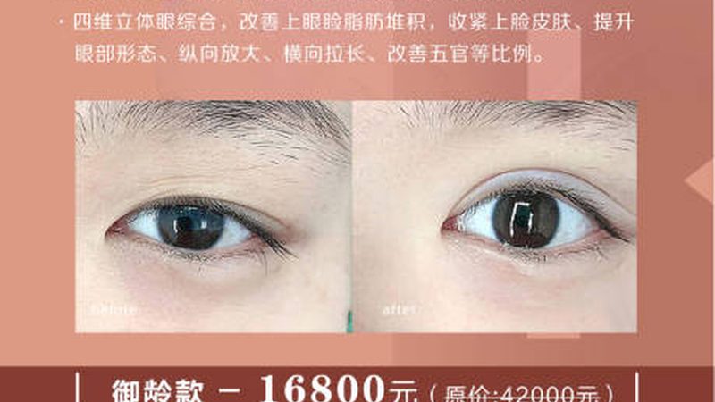 超声炮安装调试，这些关键点要知道**