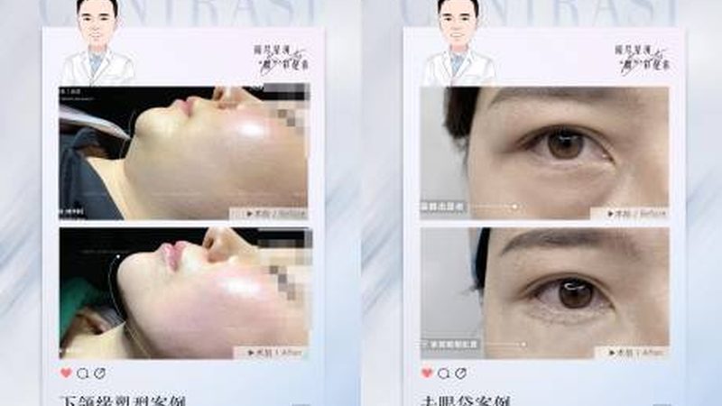 北京抗衰激光与超声刀：技术解析与选择指南