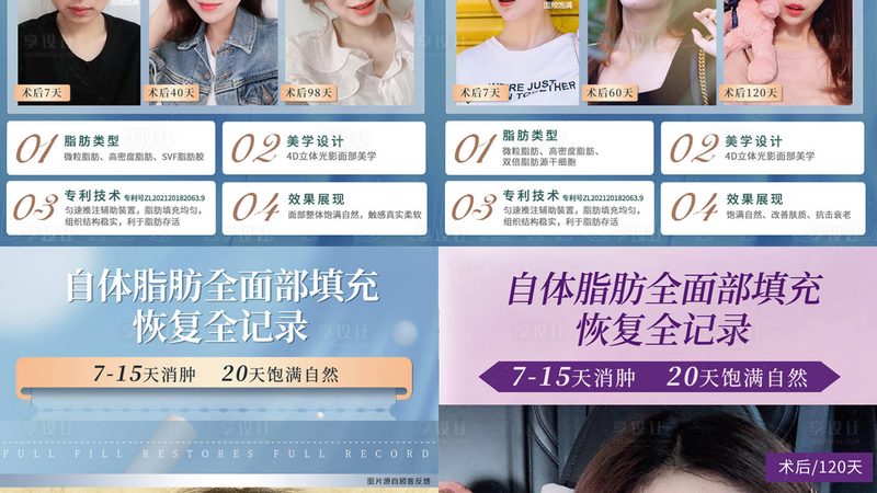 30岁，热玛吉还是线雕？揭秘两种美容项目的奥秘**