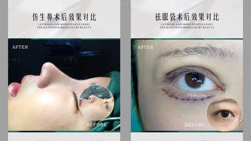 线上还是线下？揭秘医美咨询师培训的优劣势