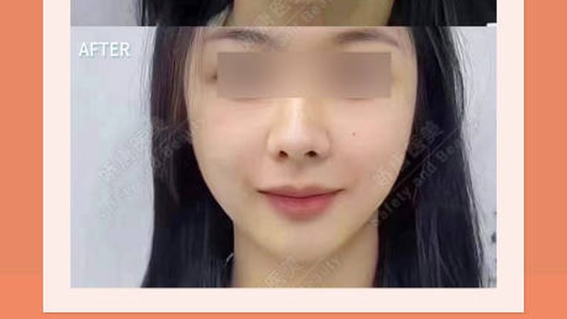 加盟皮肤管理中心前必须看清的五个真实门槛