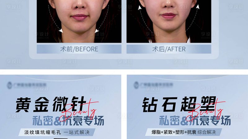 小标题：术后洗脸，时间点很重要