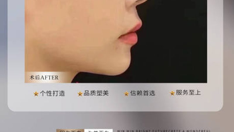 水光针和孕妇护肤品，谁更安全？一个被忽视的认知盲区