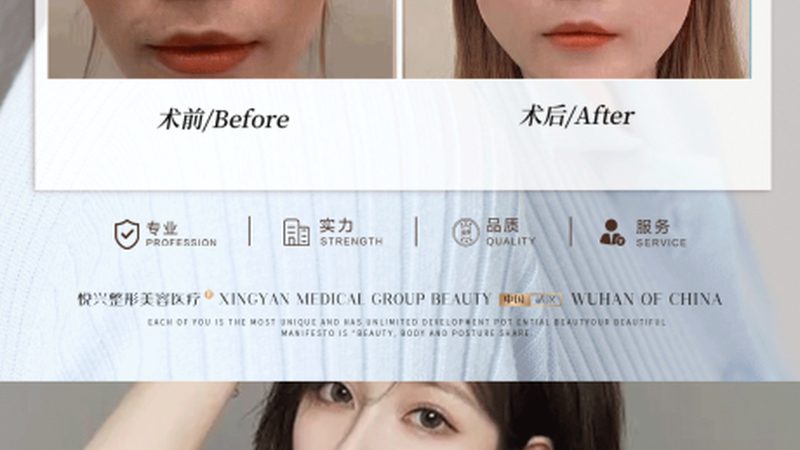 水光针保养，2025年脸部保养新趋势解析