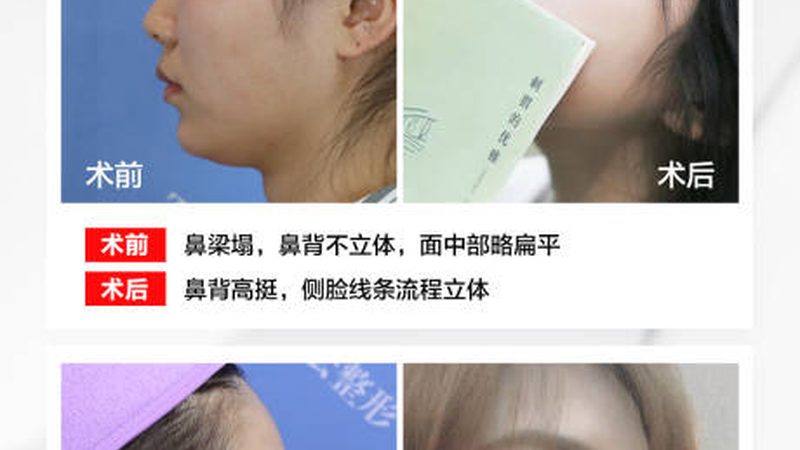 家用射频美容仪，如何挑选性价比之选？**