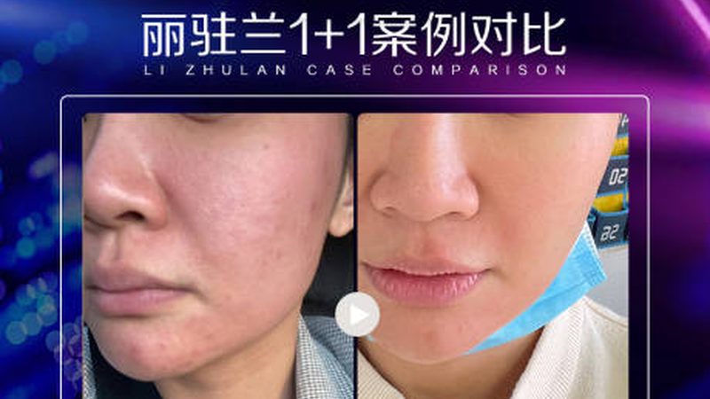 医用埋线提升线材：正规厂家的资质如何判断？**