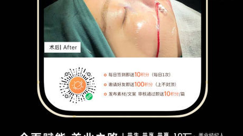 揭秘注射美容设备代理：参数标准与选购要点