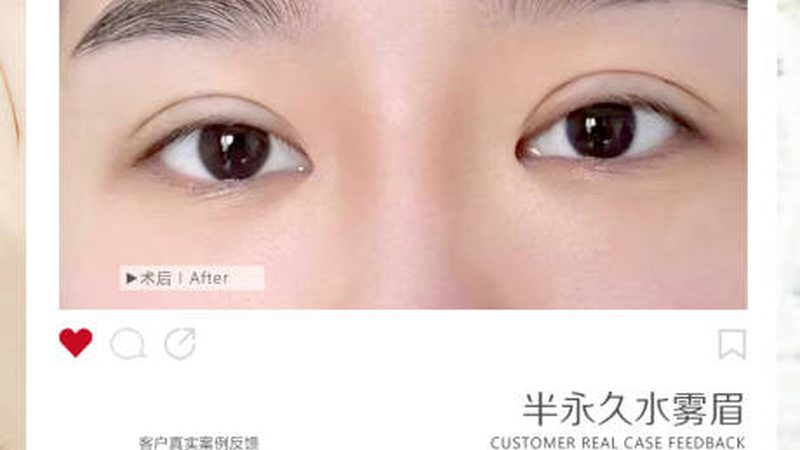 脱毛仪和美容院光电脱毛到底差在哪