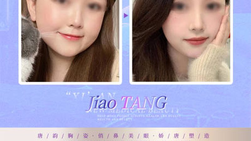 家用瘦脸仪器使用方法步骤