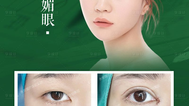 激光祛斑：效果与副作用揭秘