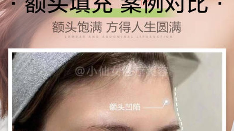 玻尿酸与假体，隆鼻选择大揭秘**
