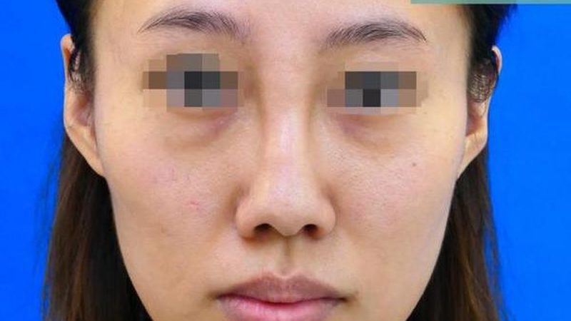 医用超声炮：揭秘其原理与选购要点